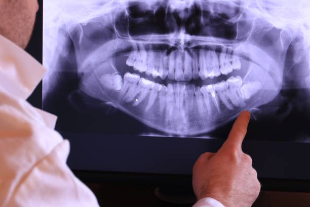 Best Emergency Dental Care for Broken or Chipped Teeth in Franklin, KY